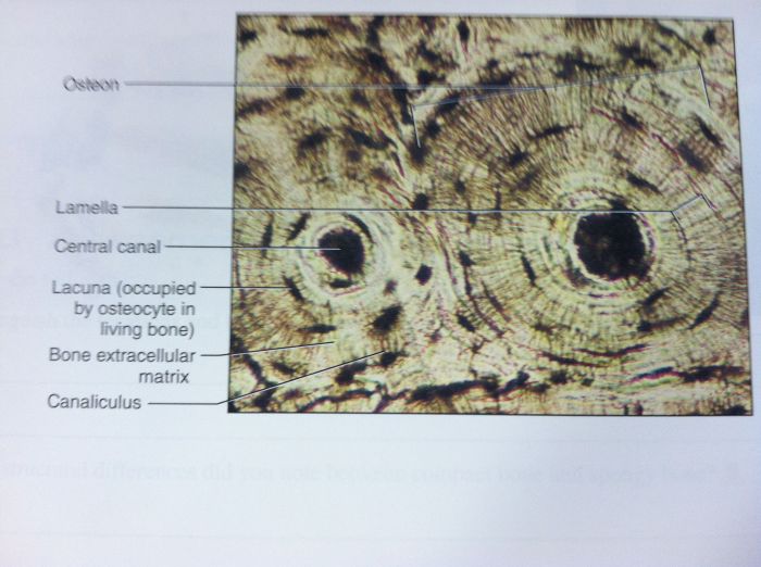 On the photomicrograph of bone below