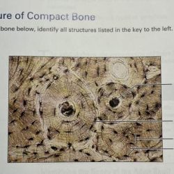 On the photomicrograph of bone below