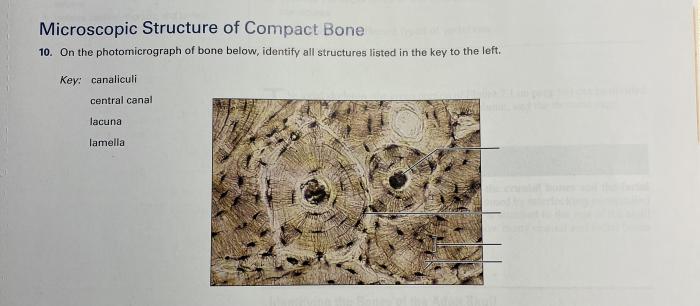 On the photomicrograph of bone below