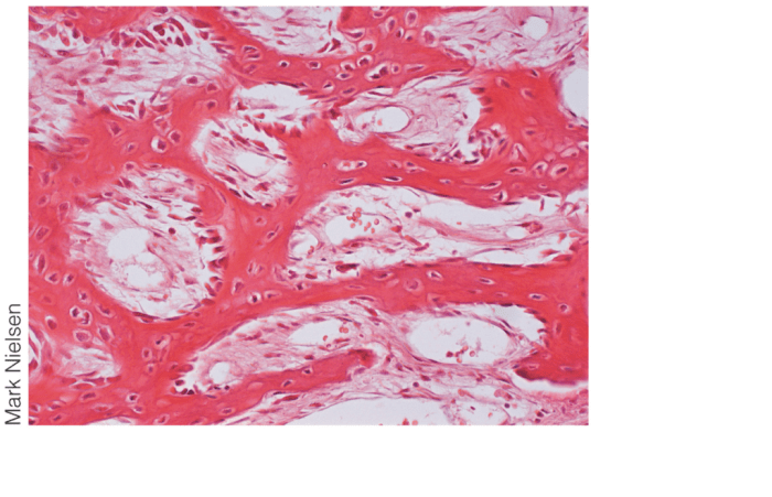 On the photomicrograph of bone below