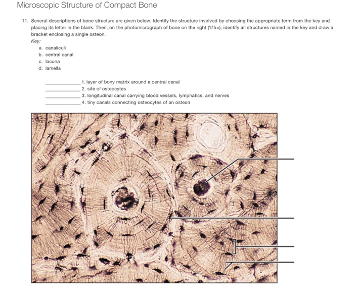 On the photomicrograph of bone below